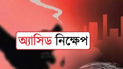 খুলনায় গৃহবধূর শরীরে অ্যাসিড নিক্ষেপের অভিযোগ